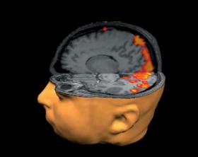 Przekrój uzyskany w wyniku badania fMRI, na którym widać aktywność mózgu w trakcie widzenia.
