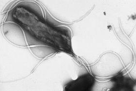 Bakteria Helicobacter pylori pod mikroskopem.