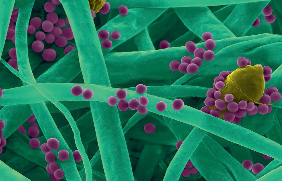 Grzyby mogą przybierać przeróżne formy. Tak wygląda ­złożona ze strzępek grzybnia jednego z rodzajów pleśni.