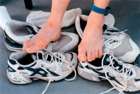 Na szczęście producenci sprzętu sportowego stają na wysokości zadania i wypuszczają na rynek buty bez szwów w środku – mniej obcierają.