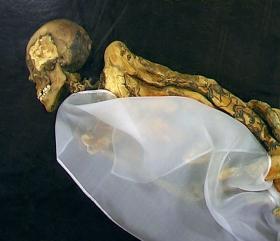 Odnaleziona przez rosyjskich archeologów w 1993 r. „Księżniczka z Ukok”, której szkielet nosi ślady zaawansowanego raka z przerzutami.