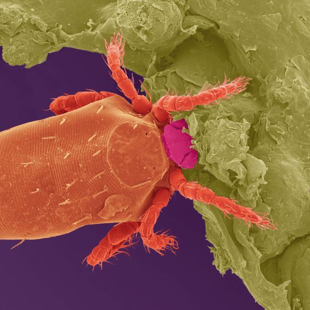 Przedstawiciel Trombiculidae (harvest mites). Postać larwalna. Zdjęcie spod mikroskopu skaningowego. Kolory nadane sztucznie.