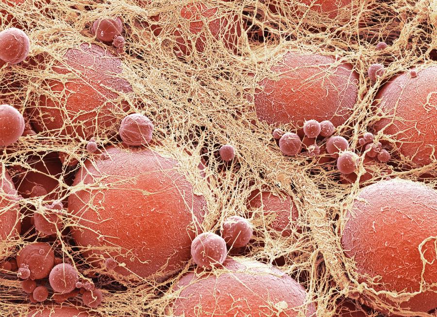 Komórki tłuszczowe zawieszone między włóknami macierzy zewnątrzkomórkowej.