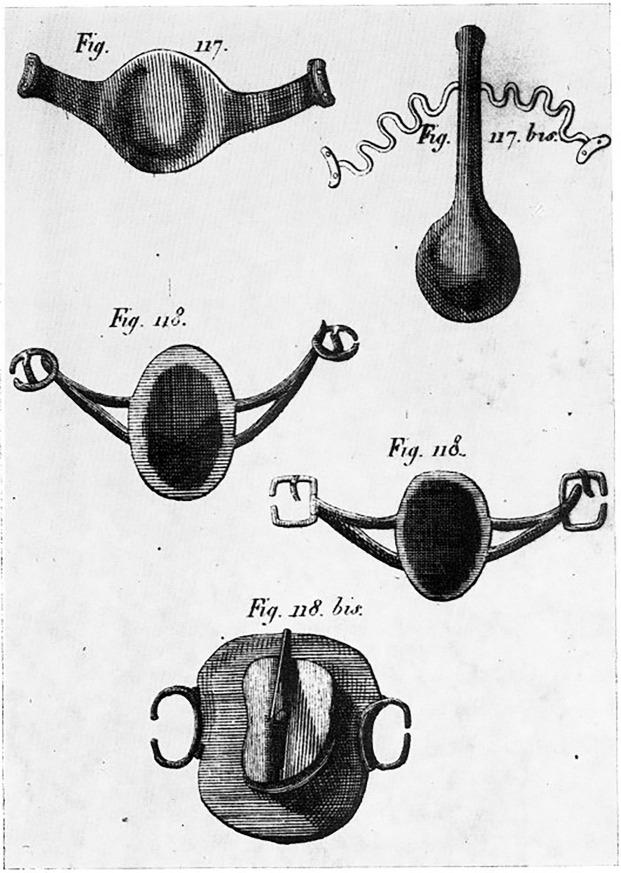 Dwa typy obturatorów E. Bourdeta (1757) z zaciskami (ryc. 117 i 117 bis). Trzy typy protez podniebiennych F. Delabarre'a (koniec XVIII w.) z klamrami (ryc. 118–118 bis).
