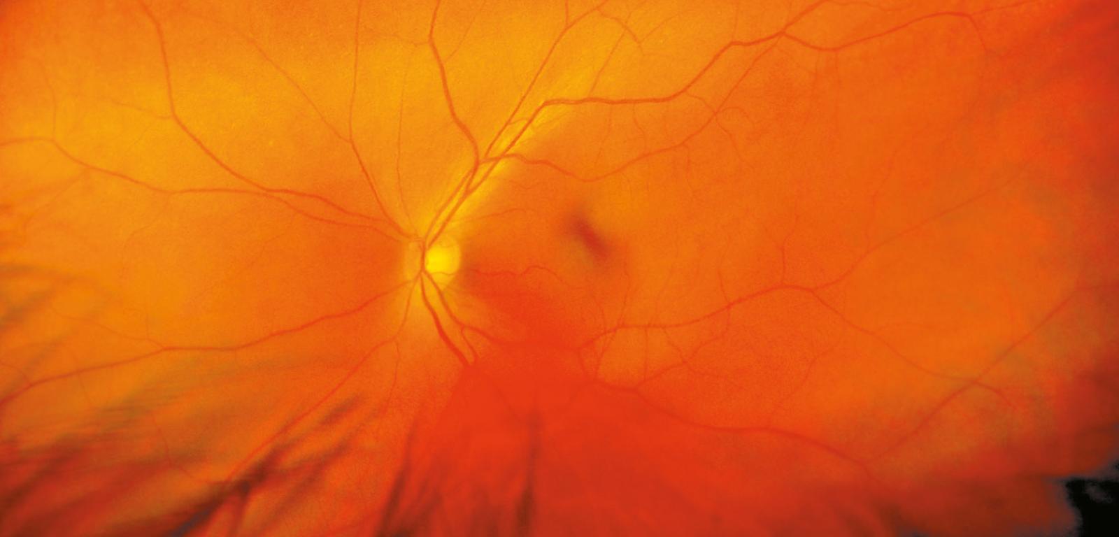 Siatkówka ludzkiego oka w powiększeniu.