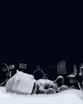 Moralny nakaz ratowania wszystkich noworodków bez względu na ich stan zdrowotny jest względnie nową ideą.