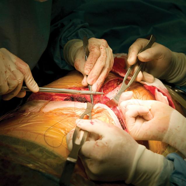 Nowa technika pozwala przez tydzień zachować poza organizmem funkcjonującą wątrobę przed jej transplantacją (na zdjęciu w trakcie zabiegu).