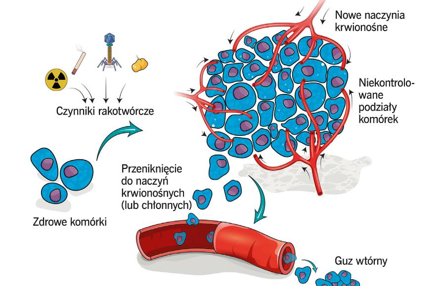 Powstawanie i przerzut nowotworu.