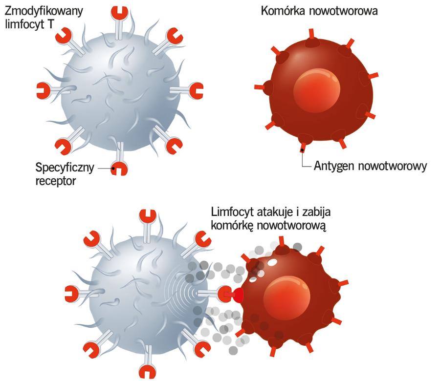 Terapia CAR-T. Zmodyfikowany genetycznie limfocyt T ma na powierzchni nowe białko (chimeryczny receptor antygenowy).