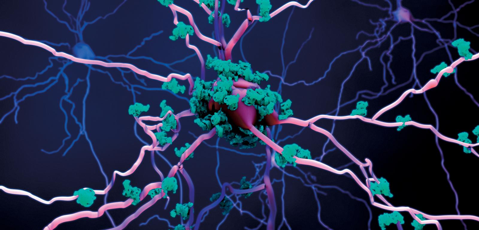 Wizualizacja 3D: zmiany funkcjonalne w mózgu (różowe neurony) niekoniecznie pojawiają się tam, gdzie wykrywany jest pierwotnie beta-amyloid (seledynowe złogi).