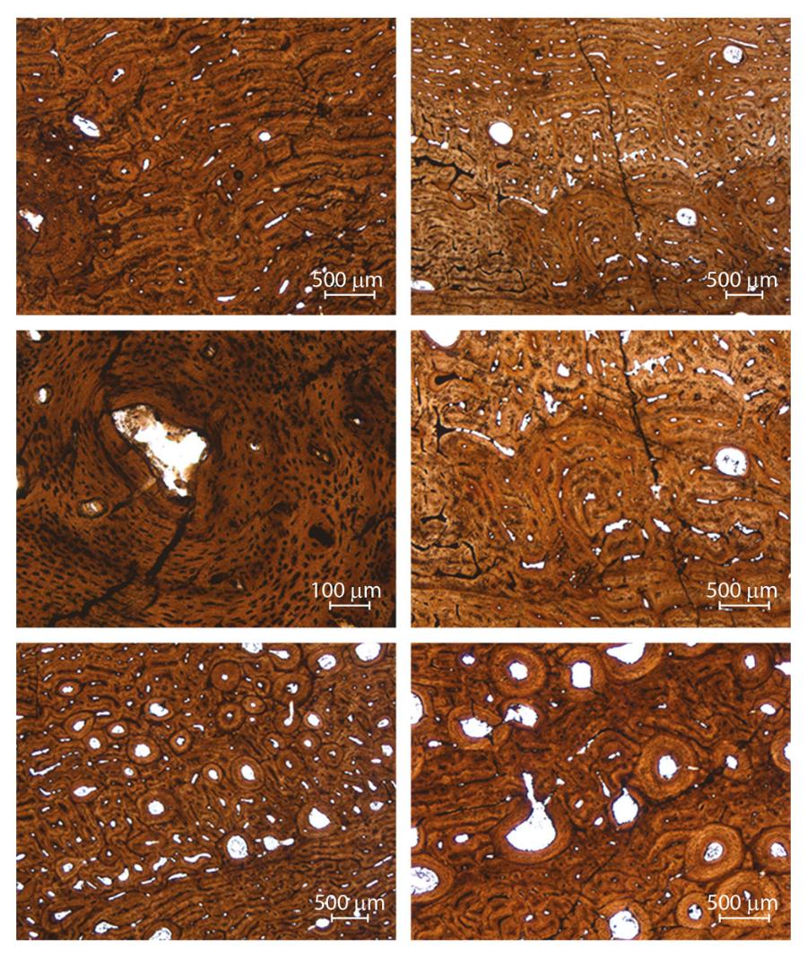 Mikroskopowe struktury wnętrza kości udowej Apatosaurus nazywanego „Jacques”; widać linie wzrostu i otwory, przez które przechodzą naczynia.
Z ”TESTING HYPOTHESIS OF SKELETAL UNITY USING BONE HISTOLOGY: THE CASE OF THE SAUROPOD REMAINS FROM  THE HOWE-STEPHENS AND HOWE SCOTT QUARRIES (MORRISON FORMATION, WYOMING, USA)”, KAYLEIGH WIERSMA-WEYAND, AURORE CANOVILLE, HANS-JAKOB SIBER i P. MARTIN SANDER, w ”PALAEONTOLOGIA ELECTRONICA', ARTYKUŁ NR 24.1.A10 HTTPS://DOI.ORG/10.26879/766, COPYRIGHT SOCIETY FOR VERTEBRATE PALEONTOLOGY, MARZEC 2021