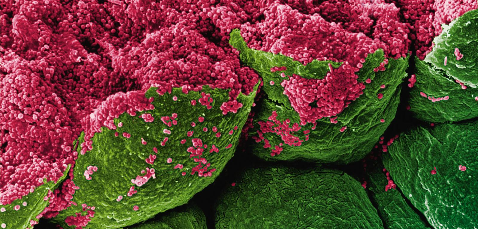 Ziarna melaniny pod skaningowym mikroskopem elektronowym. To one odpowiadają za pigmentację tęczówki.
