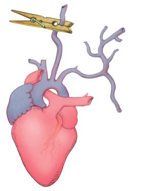 Psychologowie od dawna spostrzegli, że w sytuacji, która budzi lęk o los bliskich, ludzie dążą do jej zdefiniowania jak najszybciej, nieważne – zgodnie czy niezgodnie z prawdą.