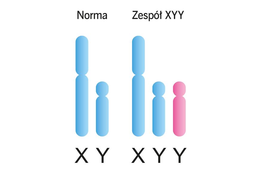 Dodatkowy chromosom Y świadczy o tzw. zespole Jacobsa (XYY). Jego objawy mogą być subtelne i niezauważalne, ale nieraz dość znaczne: nasilenie trądziku, wysoki wzrost, obniżenie napięcia mięśniowego, zaburzenia emocji i zachowania.