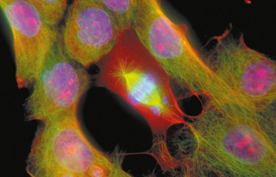 Komórki przerzutów raka wątroby na mikrofotografii w świetle spolaryzowanym. W środku zdjęcia widoczna jest dzieląca się komórka.