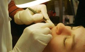 Na laserze jest co sześć tygodni. W tym czasie włosy rosną jej wolniej, ale są nadal.