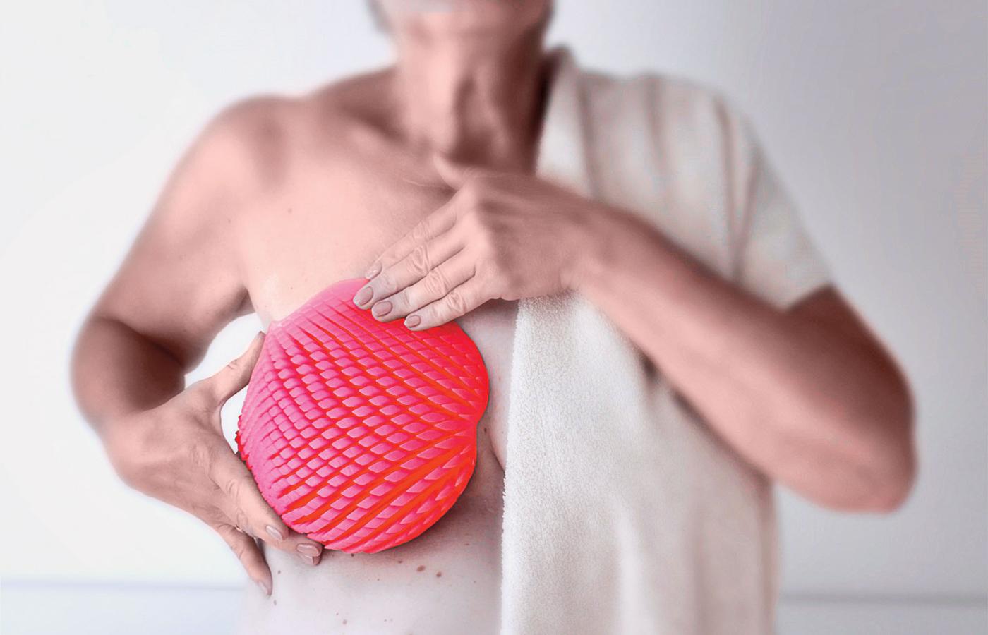 „Simpla”, zindywidualizowana proteza piersi dla kobiet po mastektomii, autorstwa Małgorzaty Załuskiej.