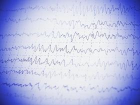 Marzenia o tym, by stworzyć preparat, który poprawiałby wydolność umysłową, to pieśń stara i dobrze znana farmakologom.