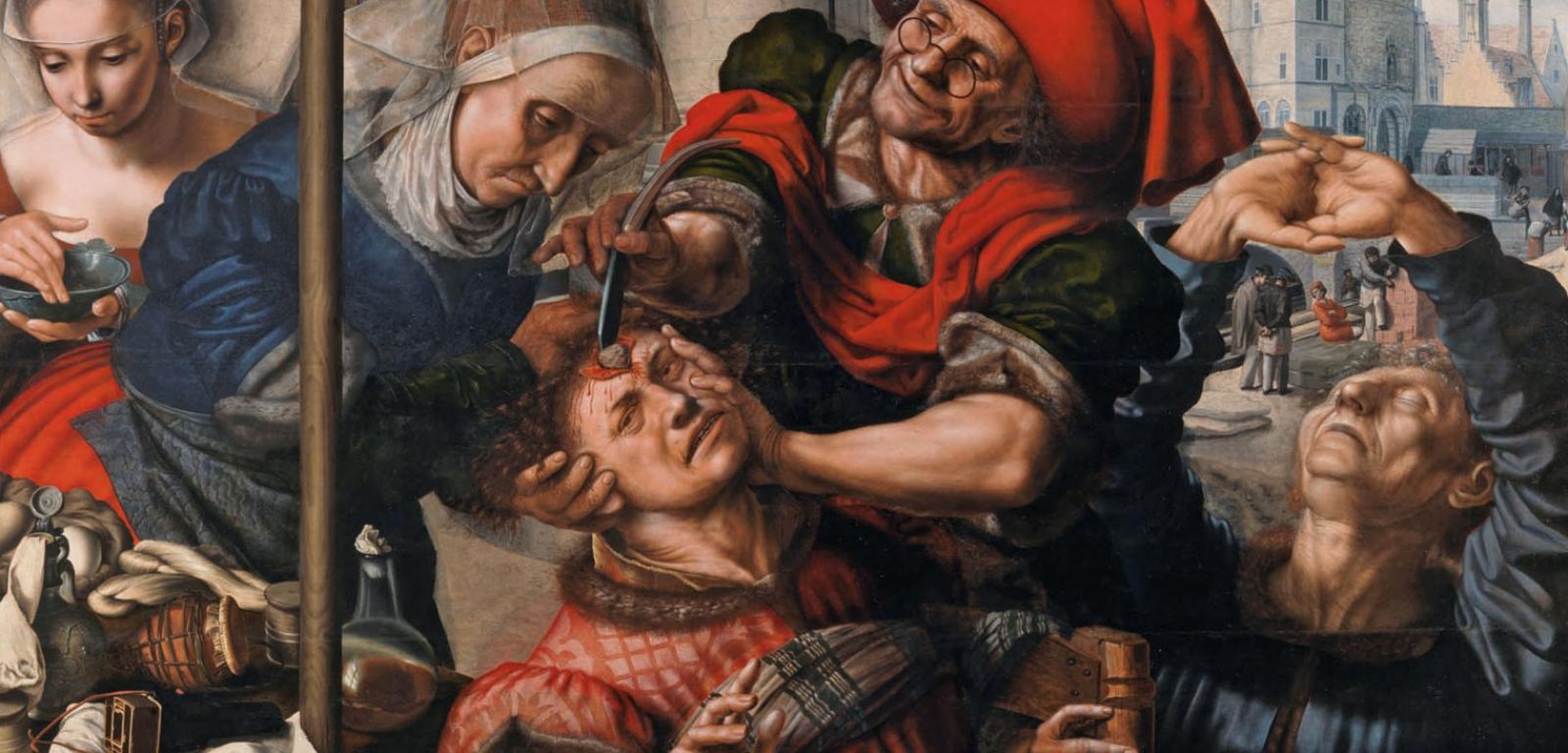 Obraz Jana Sandersa van Hemessena „Usunięcie kamienia obłędu”, znany też pod nazwą „Chirurg” (1555). Dawniej uważano, że taki kamień jest przyczyną zaburzeń psychicznych.