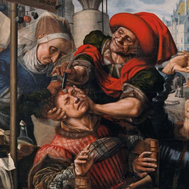 Obraz Jana Sandersa van Hemessena „Usunięcie kamienia obłędu”, znany też pod nazwą „Chirurg” (1555). Dawniej uważano, że taki kamień jest przyczyną zaburzeń psychicznych.
