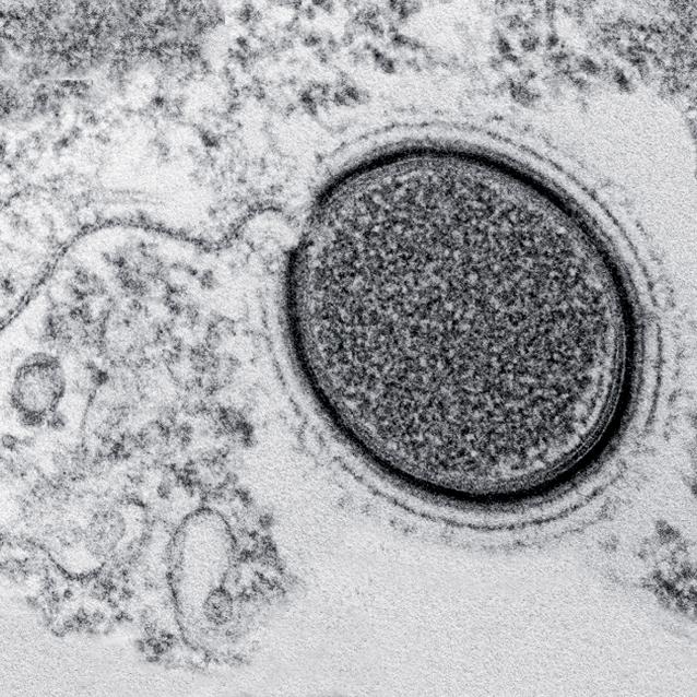 Mollivirus sibericum – wirus sprzed 30 tys. lat odkryty w 2015 r. w syberyjskiej wiecznej zmarzlinie.
