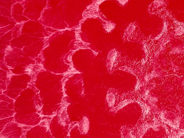 Nie ma skutecznego leku przeciwko wirusowi HIV – terapia jedynie hamuje jego namnażanie się.