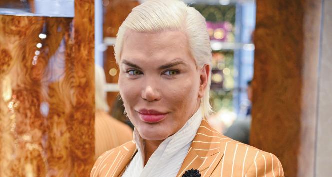 Brazylijczyk Rodrigo Alves przeszedł ponad 150 zabiegów, aby upodobnić się do lalki Ken.