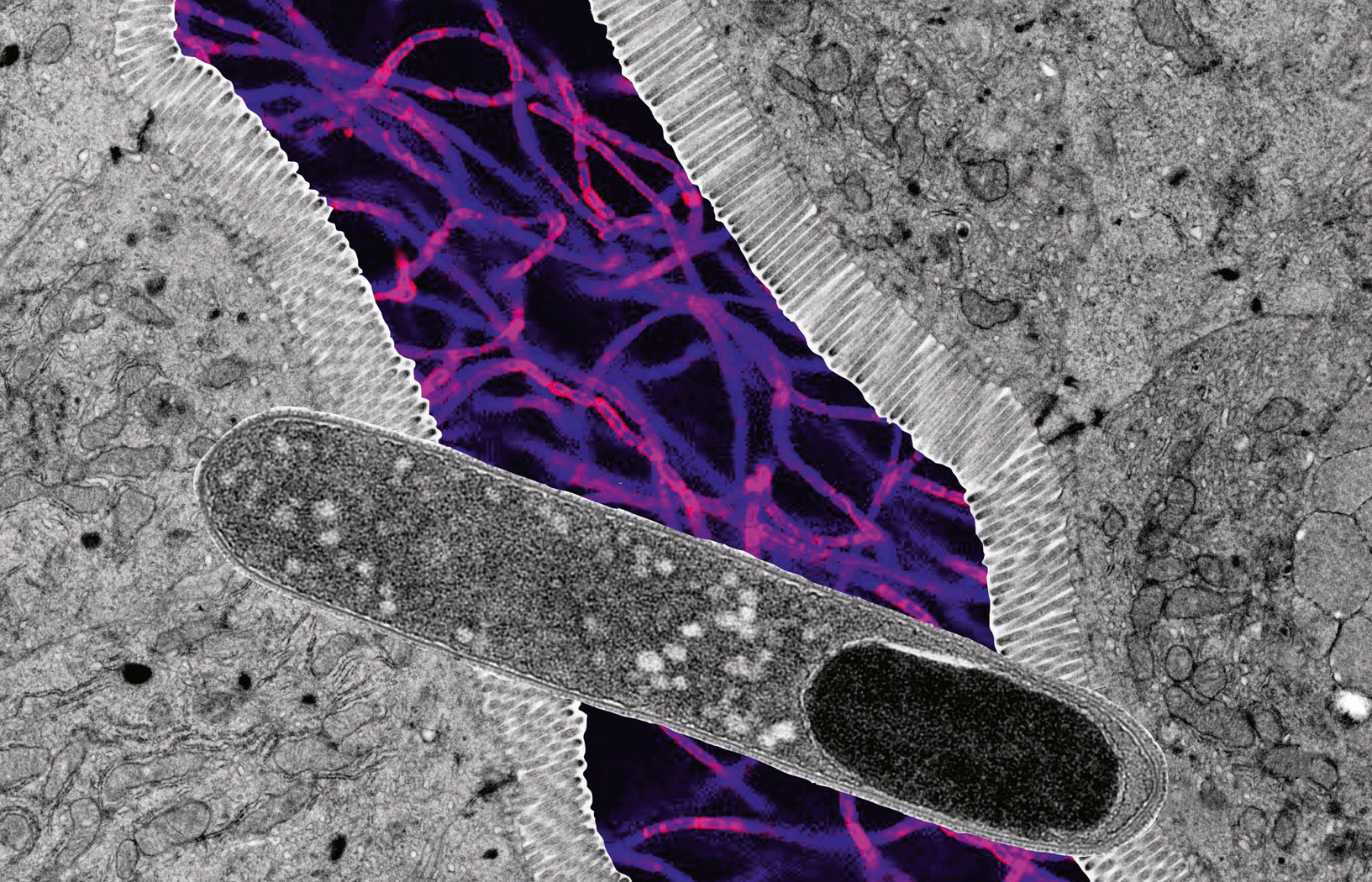 Bakteria pomaga w odchudzaniu