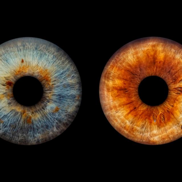 Oko ujawnia oznaki choroby Parkinsona długo przed diagnozą
