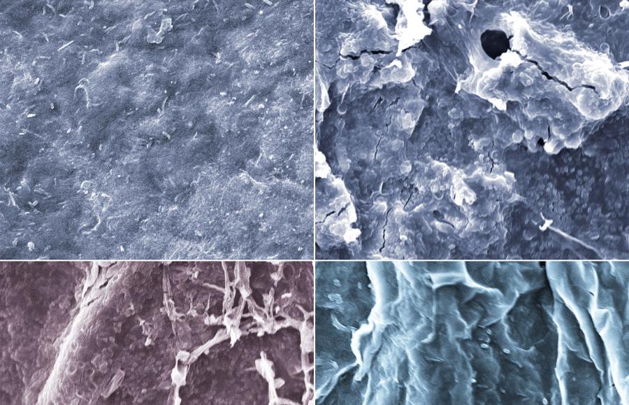 Zdjęcia mikroskopowe próbek celulozy, powiększenia około 2000 razy, kolory sztuczne. Górny rząd: próbka wyjściowa oraz próbka implantowana cynkiem poddana działaniu grzybów (widoczne liczne czarne pęknięcia świadczące o rozkładzie celulozy). Dolny rząd: obie próbki poddane działaniu grzybów – z lewej po implantacji miedzią (pęknięcia pojedyncze; w prawej części kadru widoczne nitki grzybów) oraz z prawej po implantacji srebrem (brak pęknięć).