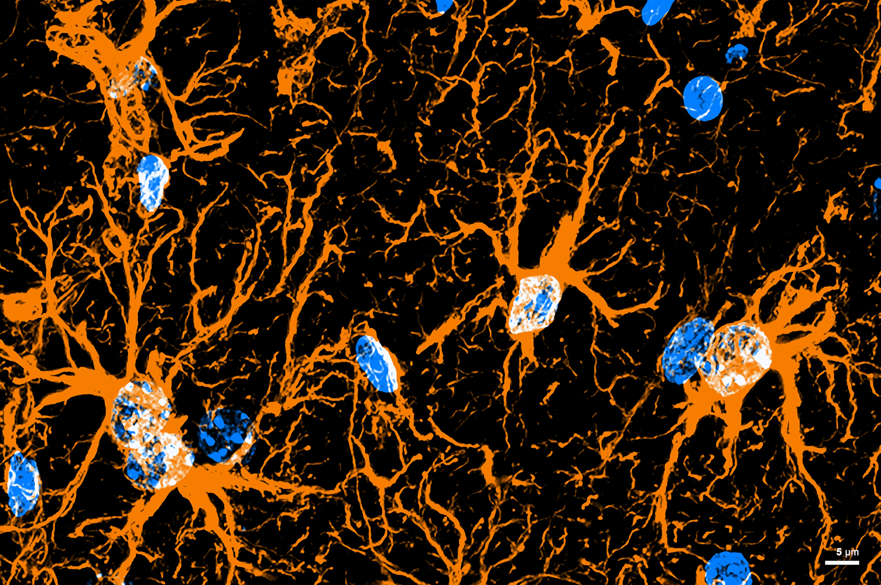 Mózg: Nie tylko neurony ze sobą rozmawiają. Ważne komunikaty przesyłają także – choćby na duże odległości – komórki gwiaździste