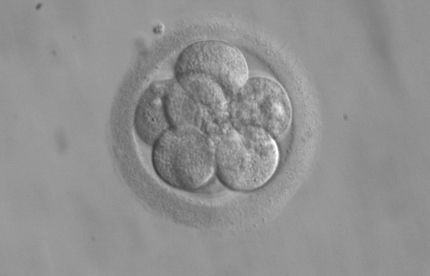 Embrion zawierający 8 komórek. Jest już gotowy do przeniesienia.