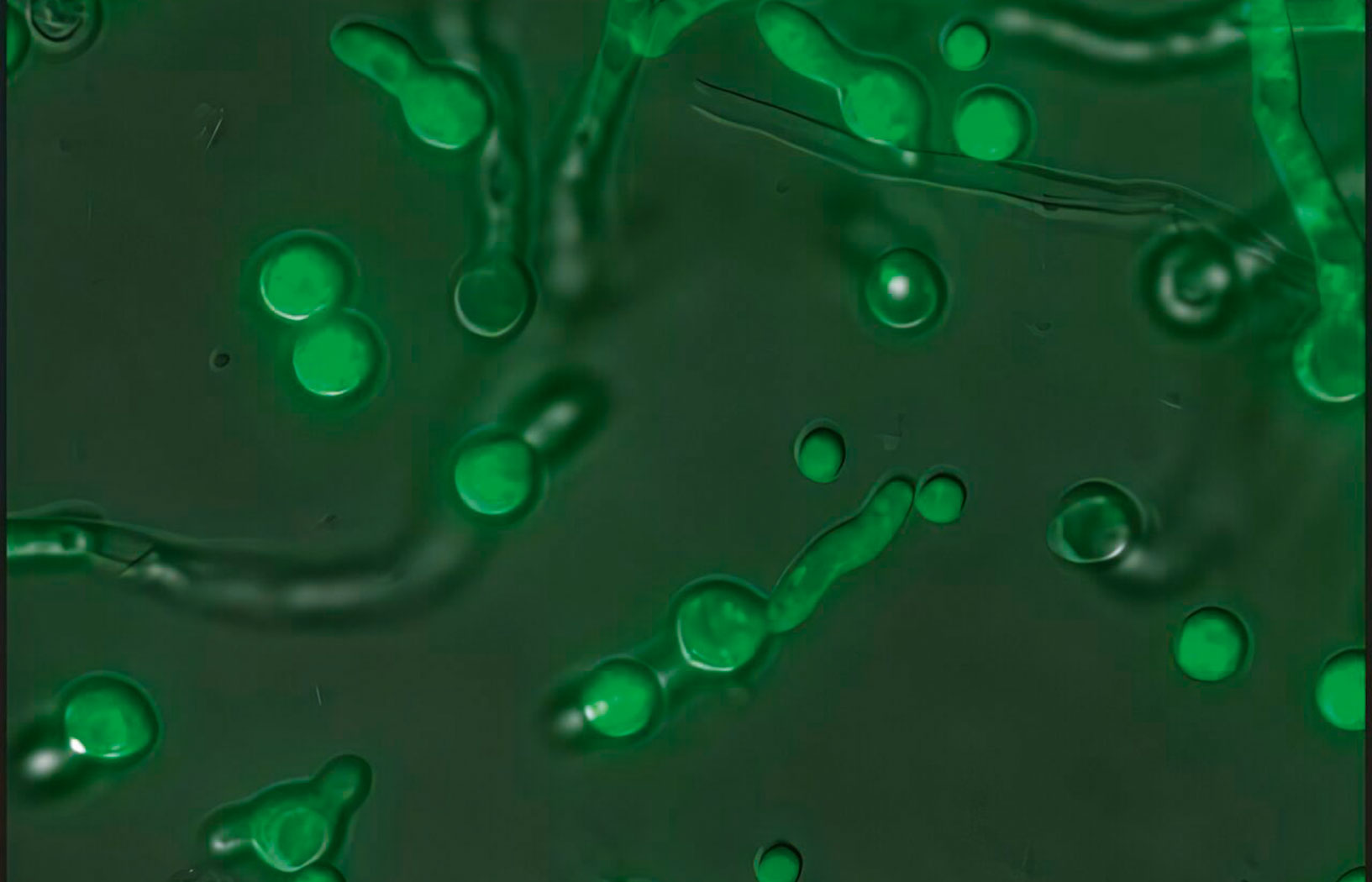 Symbiont, za pomocą którego chorobotwórczy grzyb zyskuje supermoce | Niebezpieczny symbiont