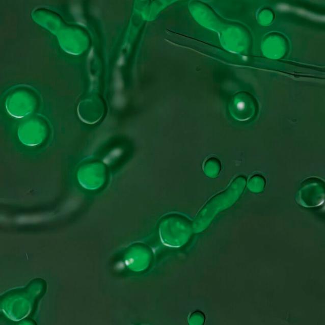 Wyznakowane fluorescencyjnie komórki kropidlaka popielatego. Obecne wewnątrz kuliste struktury powstają w odpowiedzi na czynniki stresowe i pomagają przetrwać trudne warunki środowiskowe.