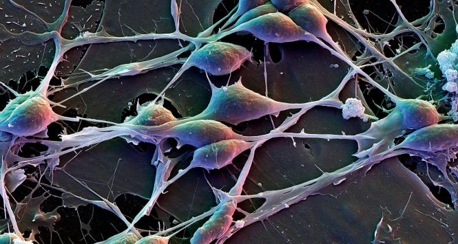 Komórki mózgowe, obraz z elektronowego mikroskopu skaningowego. Przy zdjęciu szerokości 10 cm (nasza strona jest 2 razy szersza) powiększenie wynosi 1447 razy.