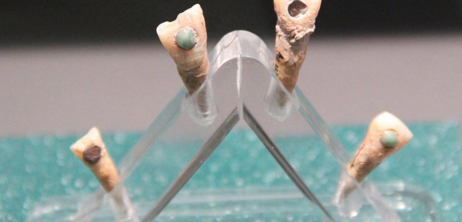 Znalezione w Gwatemali zęby ze wstawionymi ozdobnymi kamieniami.