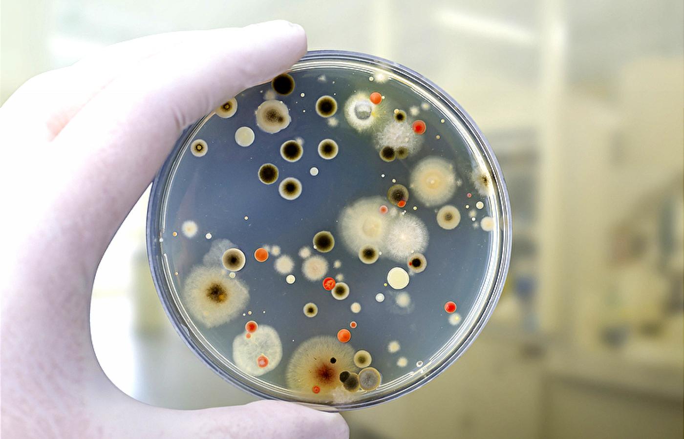 Płytka Petriego z koloniami bakterii i grzybów
