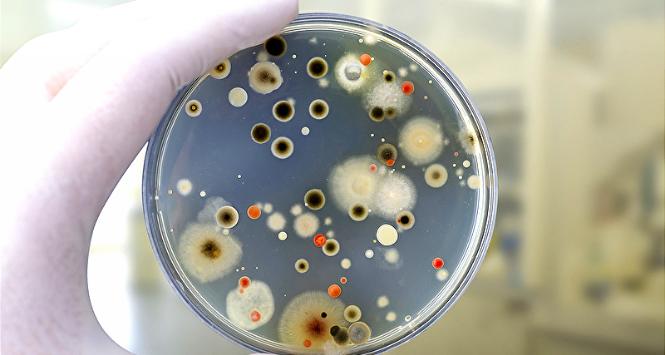 Płytka Petriego z koloniami bakterii i grzybów