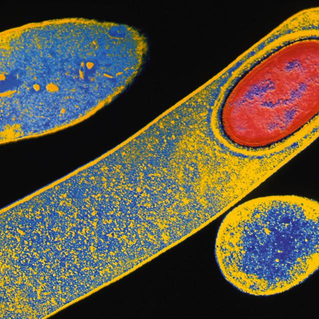 Bakteria C. difficile widziana w transmisyjnym mikroskopie elektronowym. Endospory (czerwony twór) ułatwiają tym patogenom przeżycie w niekorzystnych warunkach środowiska.