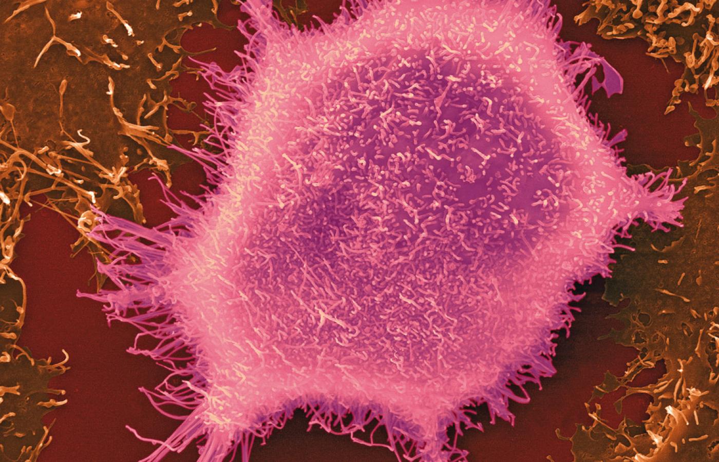 Ludzka komórka rakowa (nabłonka płuca).