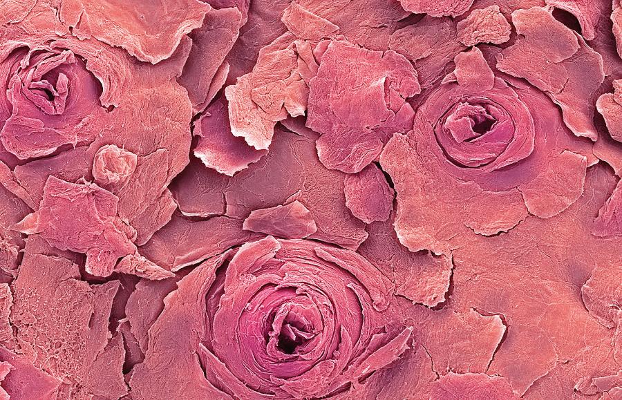 Obraz ludzkiej wargi w skaningowym mikroskopie elektronowym, z uwidocznionymi gruczołami potowymi na jej suchej, zewnętrznej powierzchni.