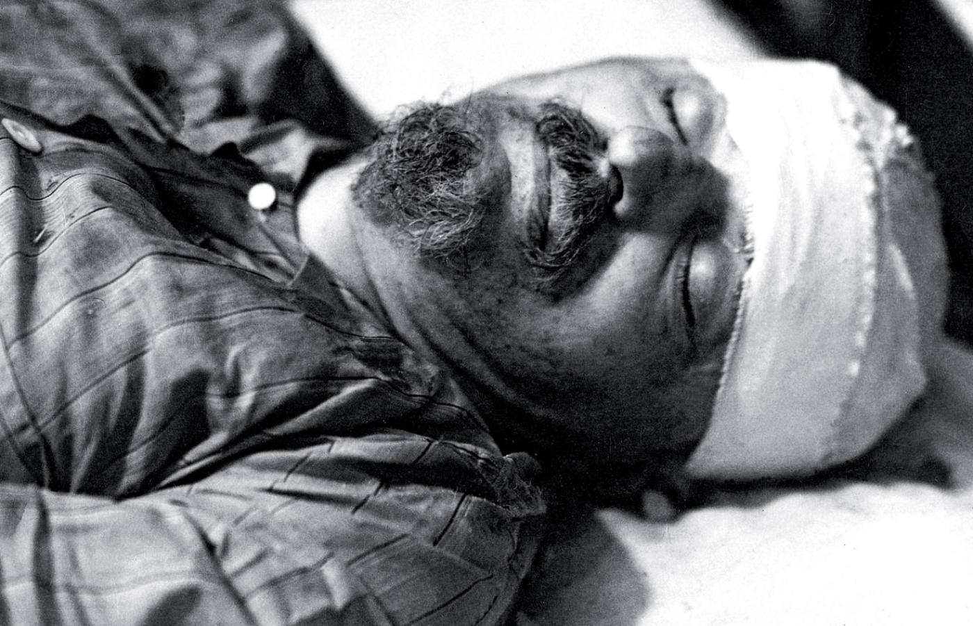 Lew Trocki przywieziony po zamachu do szpitala w Mexico City, 20 sierpnia 1940 r.