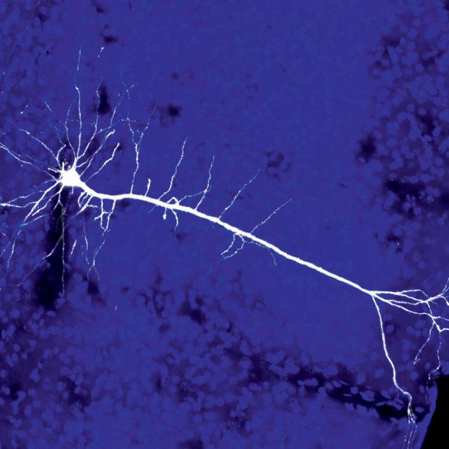 Neuron kory wzrokowej. W każdej chwili życia miliardy neuronów w naszych mózgach komunikują się ze sobą, przetwarzając docierające do nich informacje.