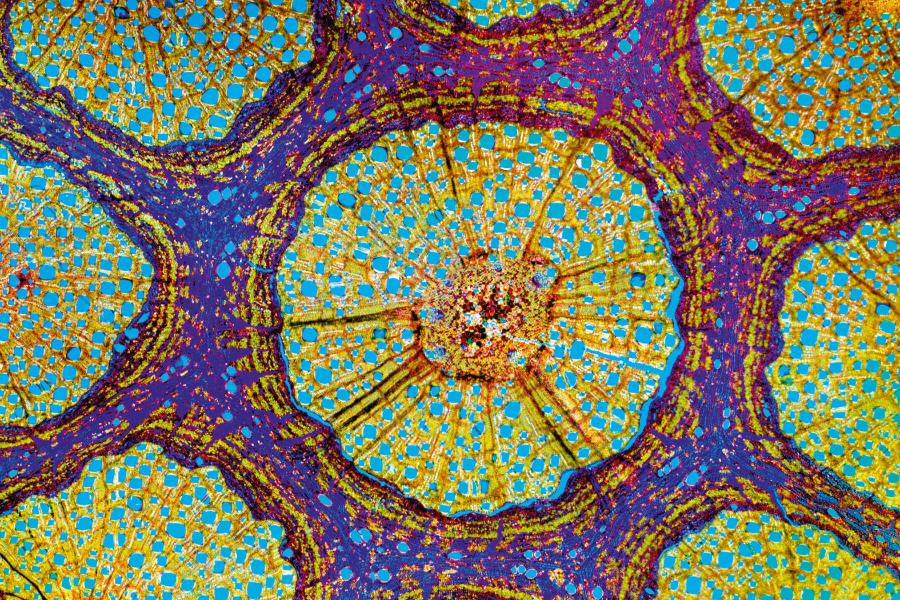 W skali komórkowej liany zwiększają np. średnicę naczyń, a w skali całej łodygi mogą wykształcać jakby wiele mniejszych „łodyg” (na zdj. widoczne w obrębie żółtych okręgów).