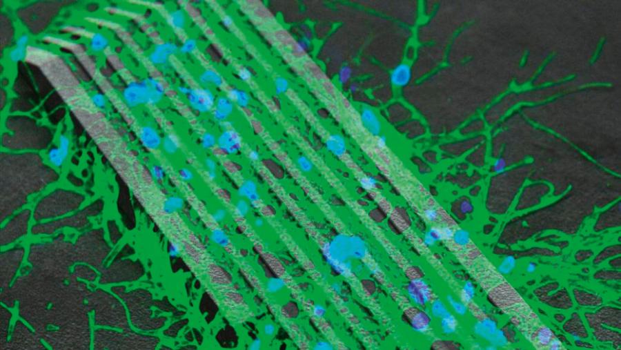 Komórki nerwowe na powierzchni mikrorobotów. Niebieskie – ciała neuronów, zielone – wypustki neuronalne.