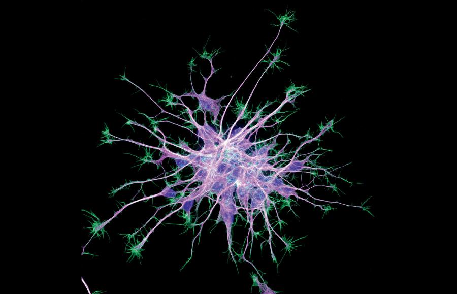 Zdjęcie spod mikroskopu fluorescencyjnego. Komórki macierzyste przekształciły się w neurony.