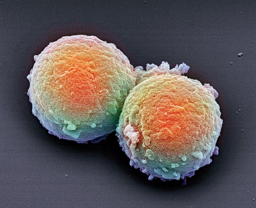 Multipotentne komórki macierzyste, które mogą przekształcić się np. w krwinki czerwone (erytrocyty) lub białe (leukocyty).