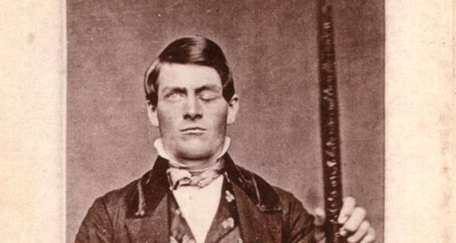 Phineas Gage z prętem, który przebił jego mózg.