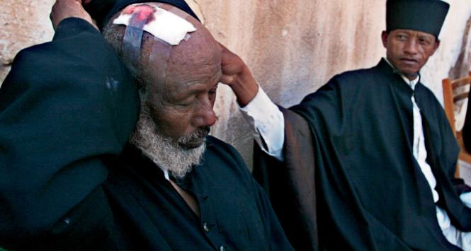 29 lipca 2002 r. Jerozolima. Ranny etiopski zakonnik po bójce mnichów