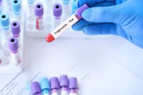 Choć lipoproteina (a) została odkryta w 1963r., dopiero ostatnie lata uwypukliły w badaniach klinicznych jej znaczenie jako markera miażdżycy.